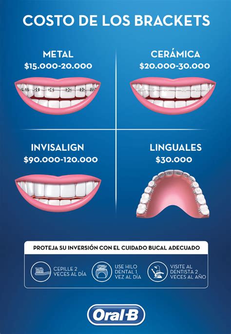 precio de brackets metalicos en mexico|cuanto cuestan los brackets.